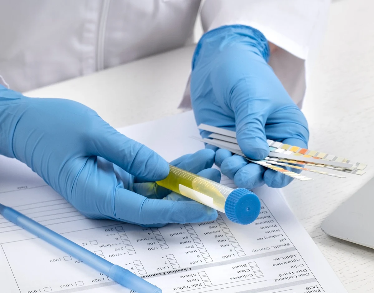Do Magic Mushrooms Show Up on a Drug Test in Ontario?